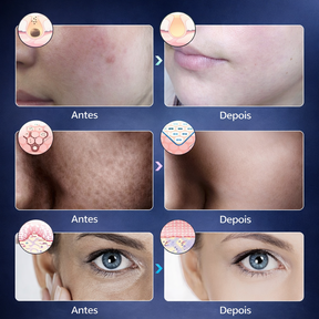 Máscara de terapia LED Facial 7 Cores SkinPulse Mask™ Rejuvenescimento e Firmeza da Pele - últimas unidades